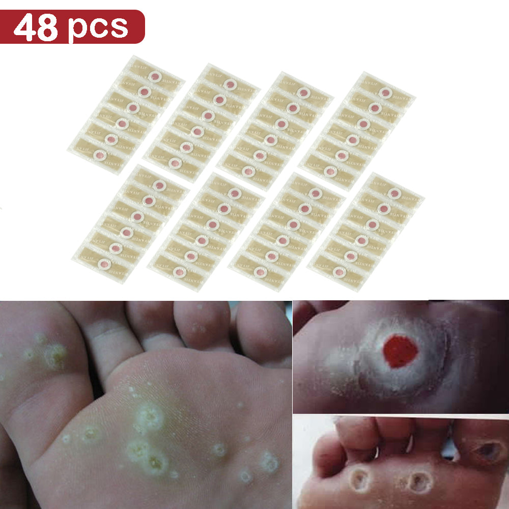 Foot Plaster Corn Removal